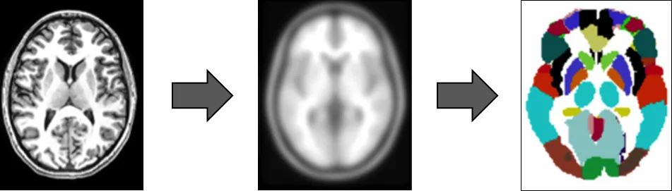 three images of the brain