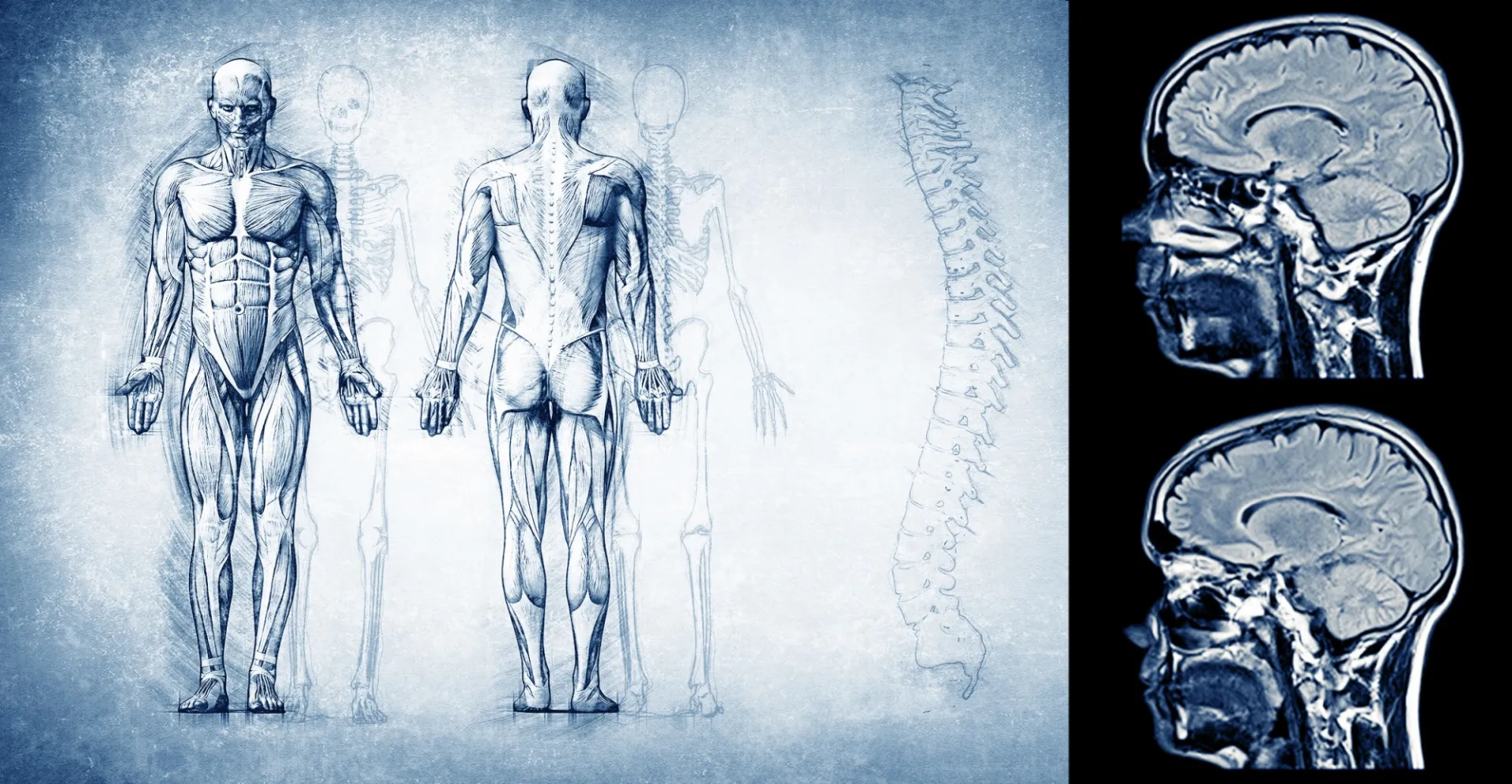 Two front and back images of the human body with fMRI scans superimposed on the image