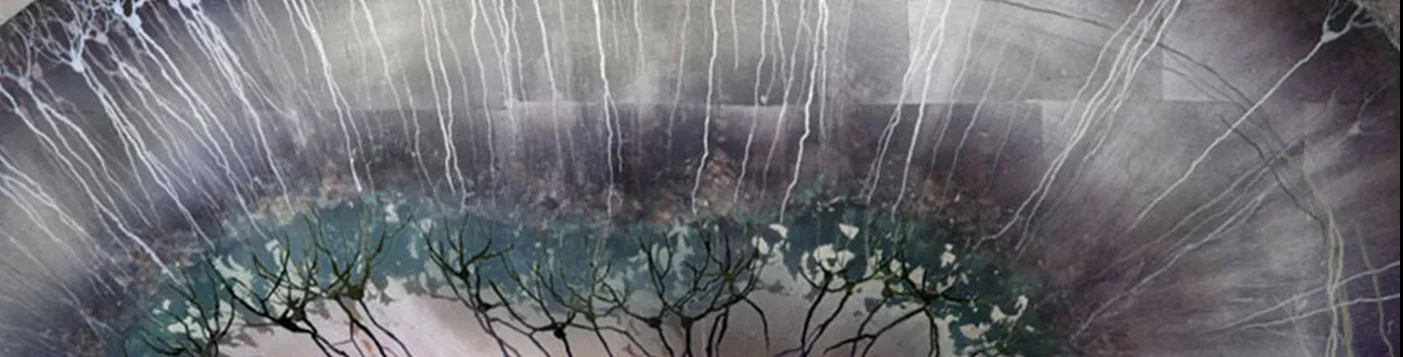 histochemistry stained brain section, view of the hippocampus
